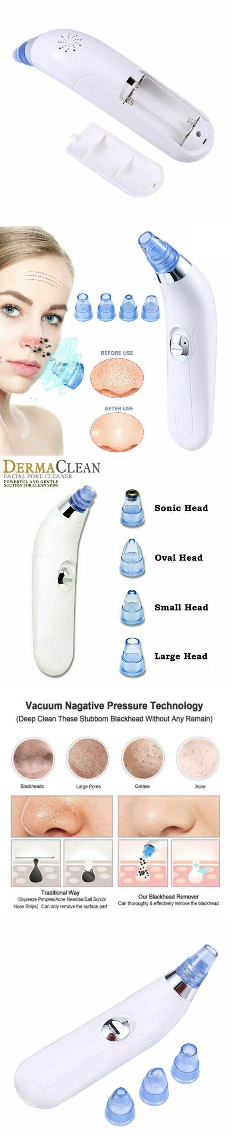 Velure™ Blackhead Vacuum