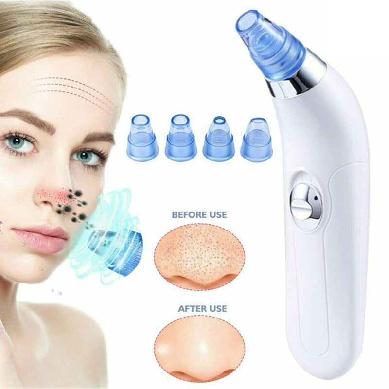 Velure™ Blackhead Vacuum