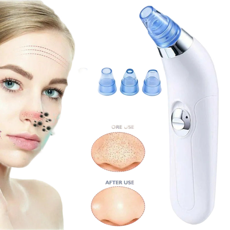 Velure™ Blackhead Vacuum